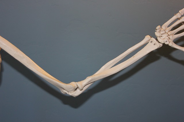 骨、関節-画像